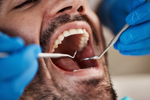 Best Emergency Gum Treatment in Riverview, SC
