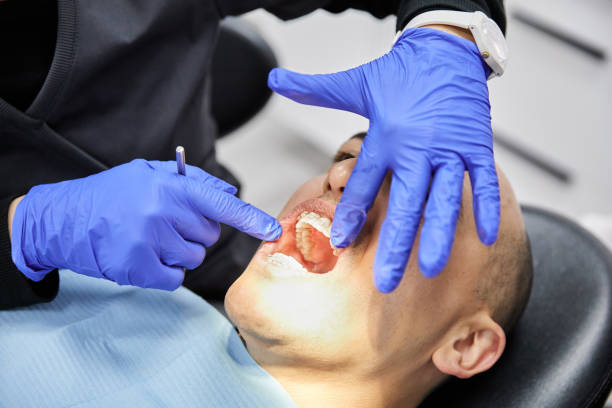Best Urgent Care for Lost Fillings or Crowns in Riverview, SC
